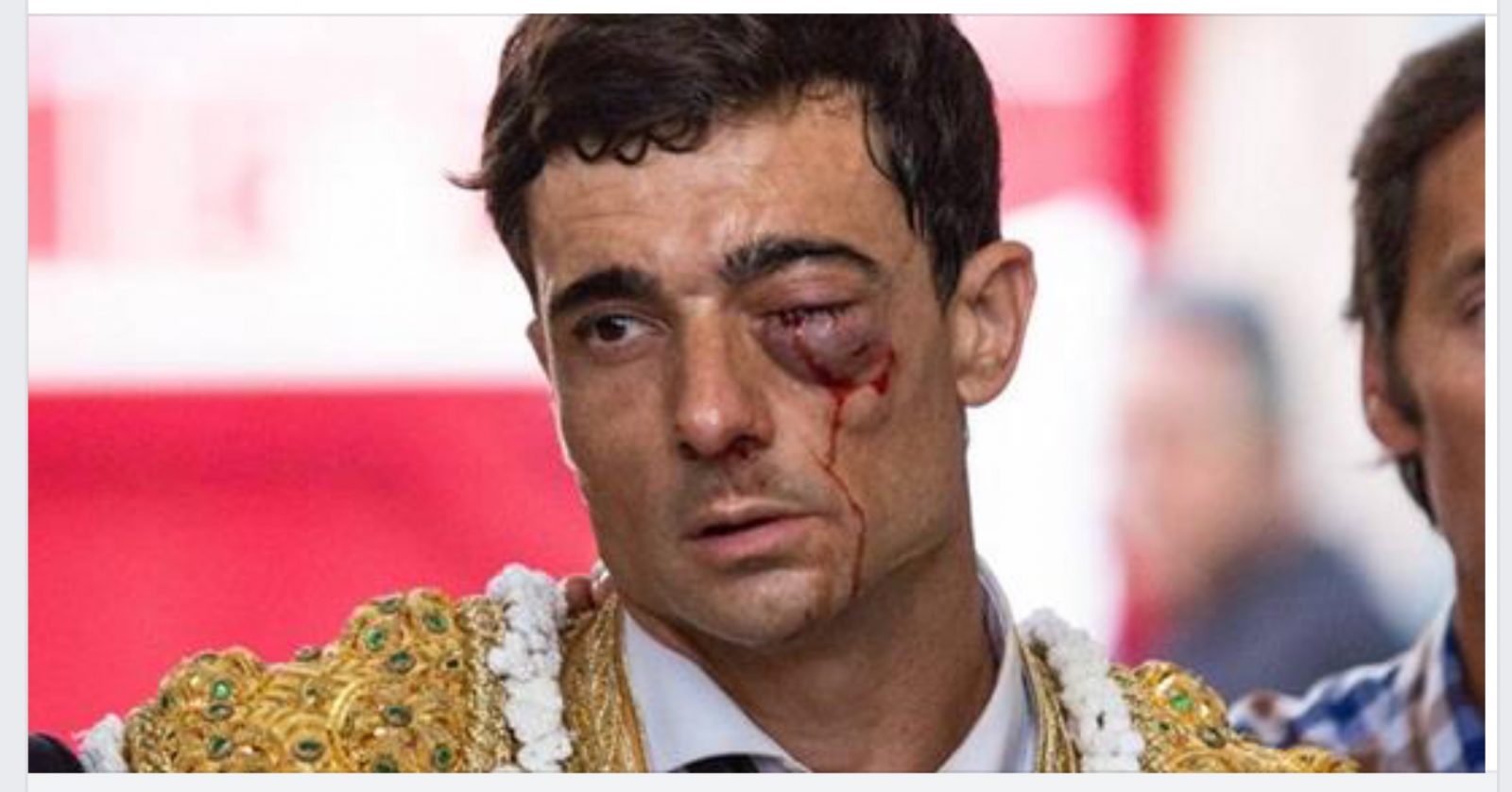 BLESSURE // PACO UREÑA sauve son oeil, mais il ne récupérera pas la vision